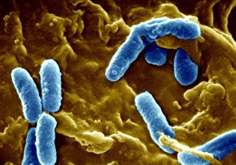  Pseudomonas aeruginosa Scanning Electron Micrograph. This bacillus causes... Stock Photos