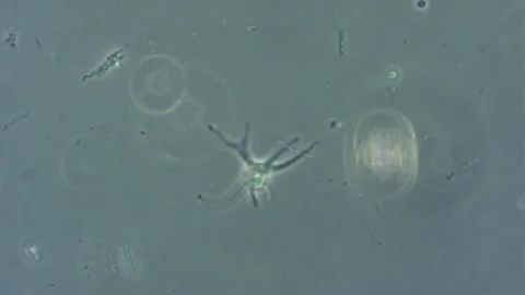 Pseudopodia of a jellyfish-like amoeba. Stock Footage 324563829
