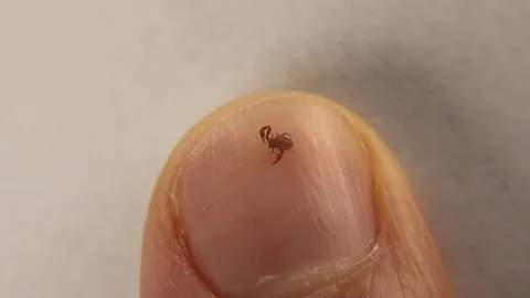 Pseudoscorpion. False scorpion size comparison on the fingernail Stock-Footage 263561456