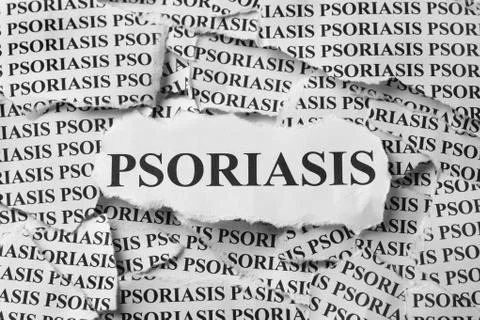 Psoriasis Foto stock
