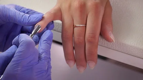 Pterigy removal machine macro manicure Video stock 103830712