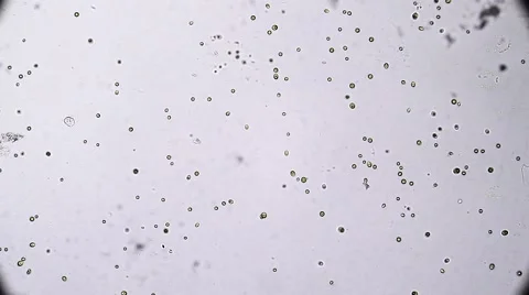 Pteromonas Angulosa alga-Algae Stock Footage 65523751