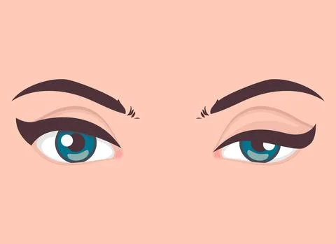 Ptosis of the upper eyelid, optical problem with eye, medical vector Stock Illustration
