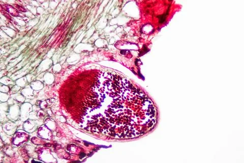 Puccinia microscope slide Photos