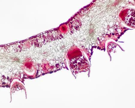 Puccinia microscope slide Photos