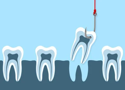 Pull a tooth Stock Illustration