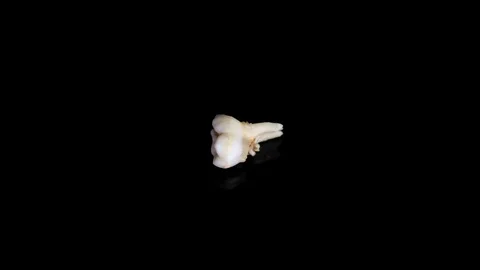 Pulled out baby tooth on a black background. Extracted tooth isolated on black Video stock 129840182