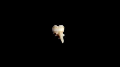 Pulled out baby tooth on a black background. Extracted tooth isolated on black Video stock 129840336