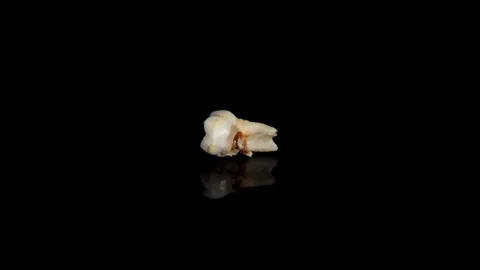 Pulled out baby tooth on a black background. Extracted tooth isolated on black Stock-Footage 129840413