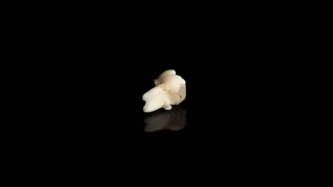 Pulled out baby tooth on a black background. Extracted tooth isolated on black Video stock 129840488