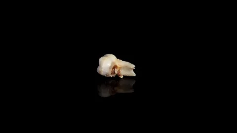 Pulled out baby tooth on a black background. Extracted tooth isolated on black Video stock 129840547