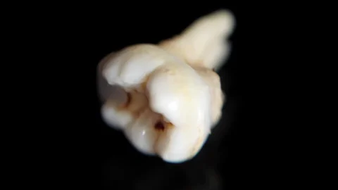 Pulled out baby tooth on a black background. Extracted tooth isolated on black Vidéo 129840717