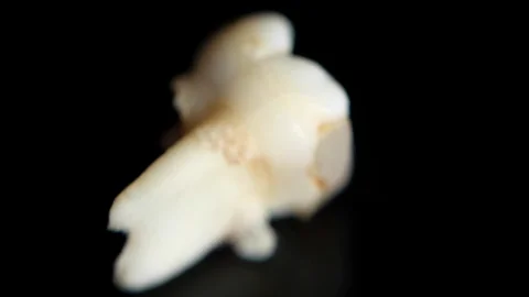 Pulled out baby tooth on a black background. Extracted tooth isolated on black Video stock 129840911