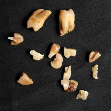 Pulled teeth on black Stock Photos