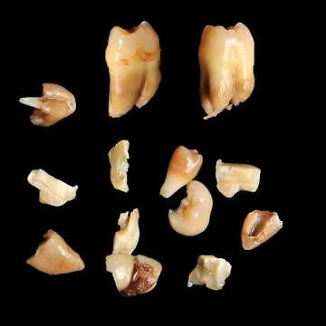 Pulled teeth on black Stock Photos