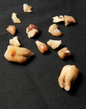 Pulled teeth on black Stock Photos