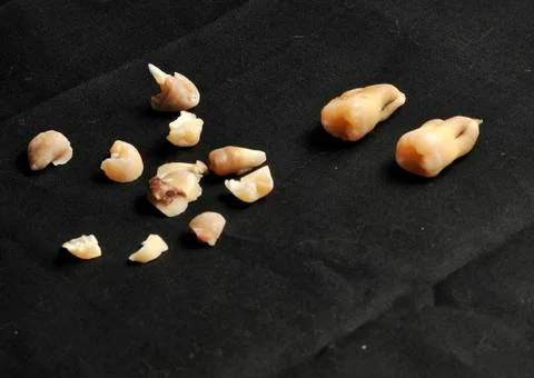 Pulled teeth on black Stock Photos