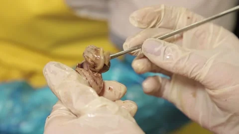 Pulling the snail from the shell Stock Footage 151534430