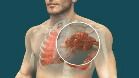 Pulmonary alveolus Illustrazione stock