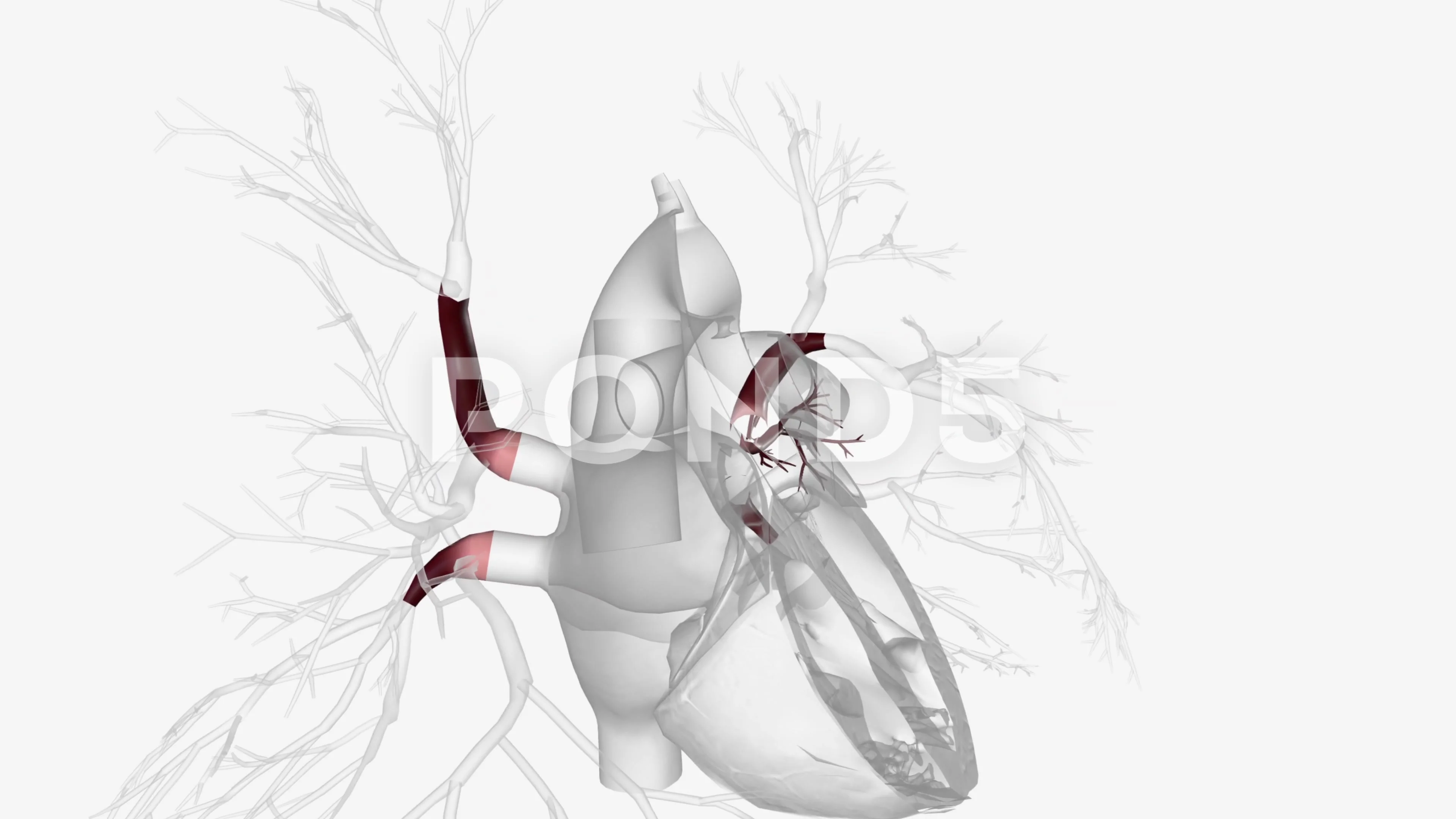 pulmonary arteries carry oxygen poor blood from your heart to your lungs. Your