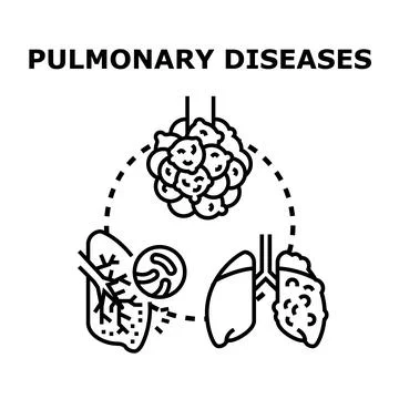 Pulmonary diseases concept exploring various lung conditions 스톡 일러스트