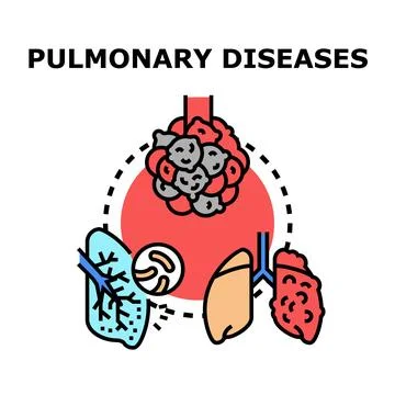 Pulmonary diseases concept exploring various lung conditions 스톡 일러스트