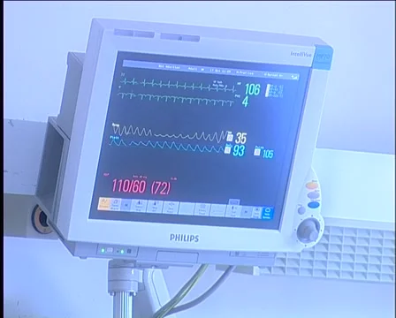 Puls 库存影片 995317