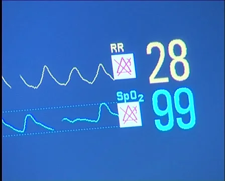 Pulse Stock Footage 995542