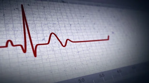 Pulse Stock Footage 33866805