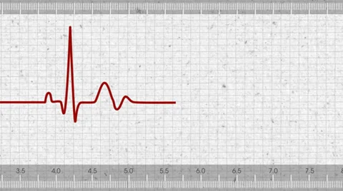 Pulse Stock-Footage 33866839