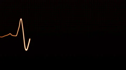 Pulse HD Stock Footage 23458084