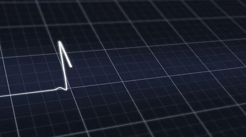 Pulse heart rate chart - Seamless Loop Video stock 56812594