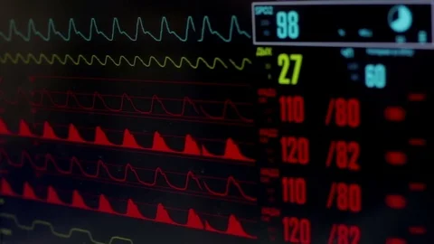 Pulse in the Hospital Stock Footage 69877684