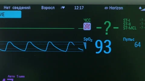 Pulse schedule Stock Footage 68143562