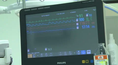 Pulse schedule Stock Footage 68143932