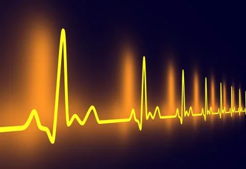 Pulse trace. 스톡 일러스트