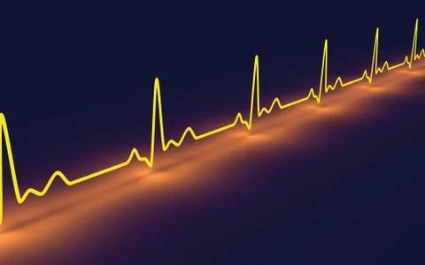 Pulse trace. Illustrazione stock