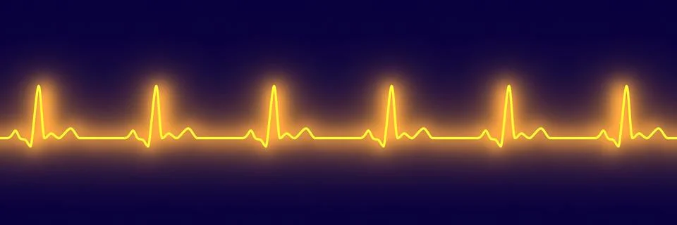 Pulse trace. Illustrazione stock
