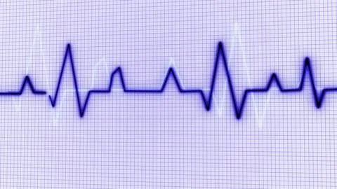 Pulse trace white background Illustrazione stock