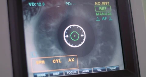 Pupil close-up on apparatus for the detection of glaucoma Stock Footage 90267490