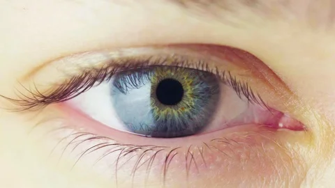 Pupil Constriction Process in Human Eye Stock-Footage 103306736