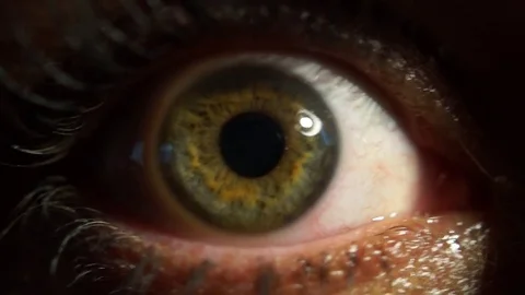 Pupil reaction to light 库存影片 74231487