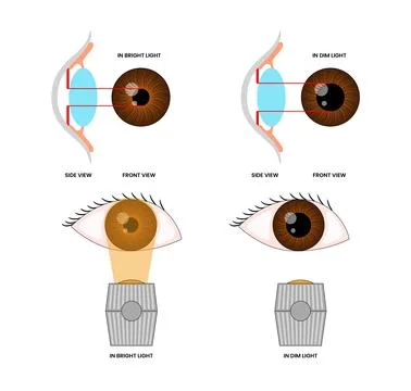 Pupil Size in Different Lighting, Diagram Healthcare, Educational Medical P.. Stock Illustration