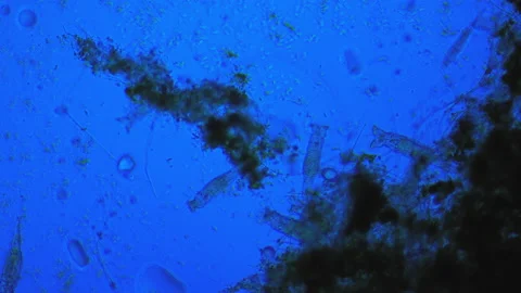 Purification of contaminated water sources using microorganisms. Boiling life Stock Footage 165076174