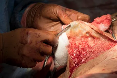 Purify the pelt using scalpel Foto stock