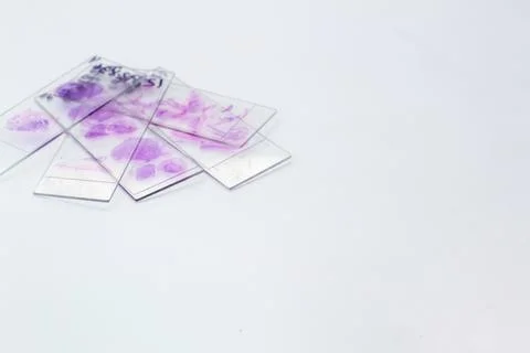 Purple-stained microscope slides on white surface, laboratory sample prepar.. Stock Photos