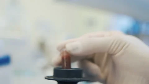 Put red solution into laboratory shaker close up Vídeos de archivo 158526115