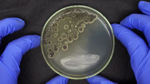 Puts a petri dish with bacteria on a black table Stock Footage 241106199