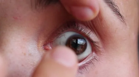 Putting in, applying the contact lens, macro Stock Footage 68569878