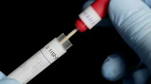 Putting DNA swab into tube Stock Footage